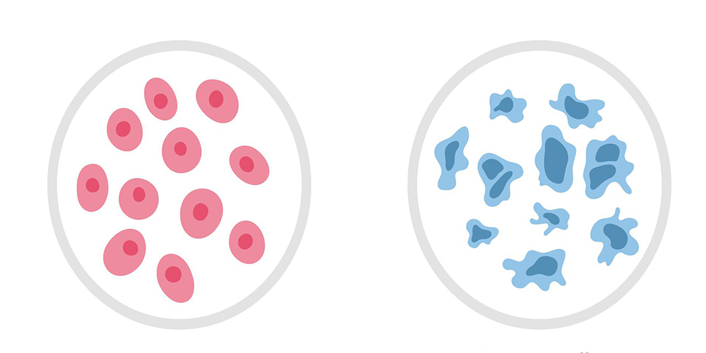 تفاوت بین سلول های سالم و سلول های سرطانی