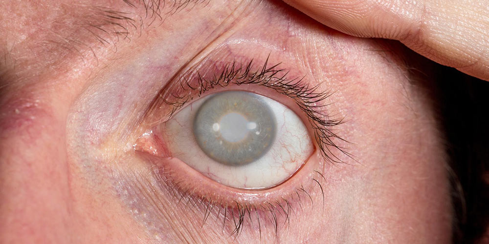 راه‌های مراقبت از چشم ها در بیماران دیابتی