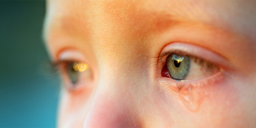 آلرژی چشم یکی از انواع بیماری های چشم