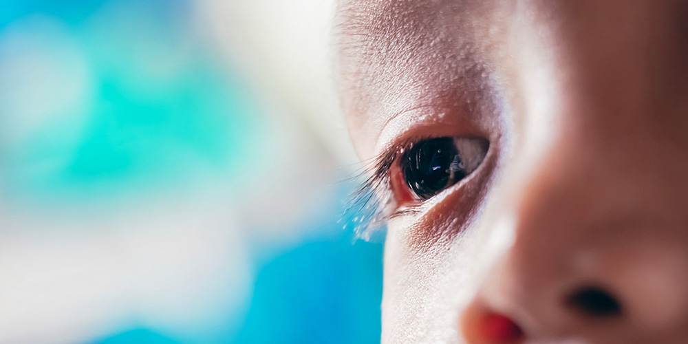انحراف چشم یکی از انواع بیماری های چشم است